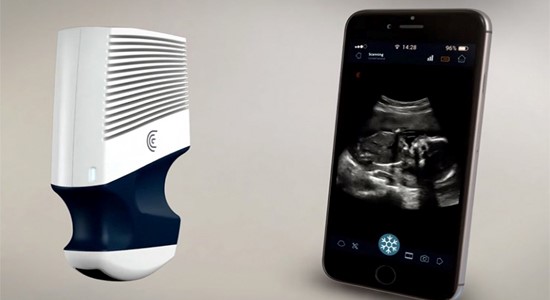 可隨身攜帶的超聲波設備