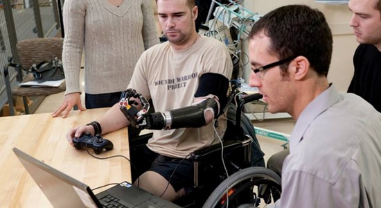 用意念控制的假肢